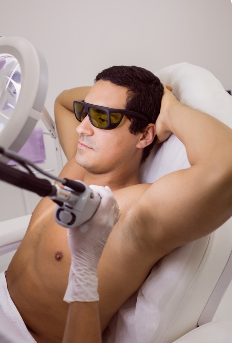 LASER TREATMENT FOR HAIR REMOVAL